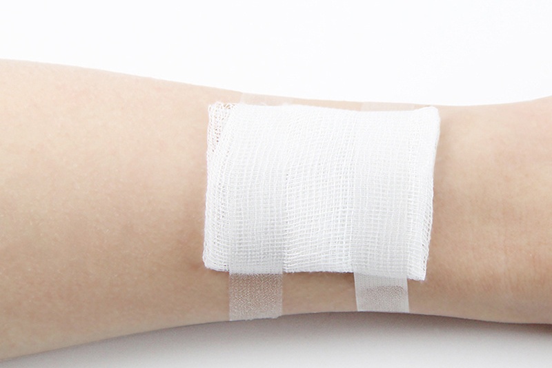 Application of Medical Breathable Tapes