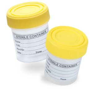 Urine Container, urine cup, Urine Collection Container